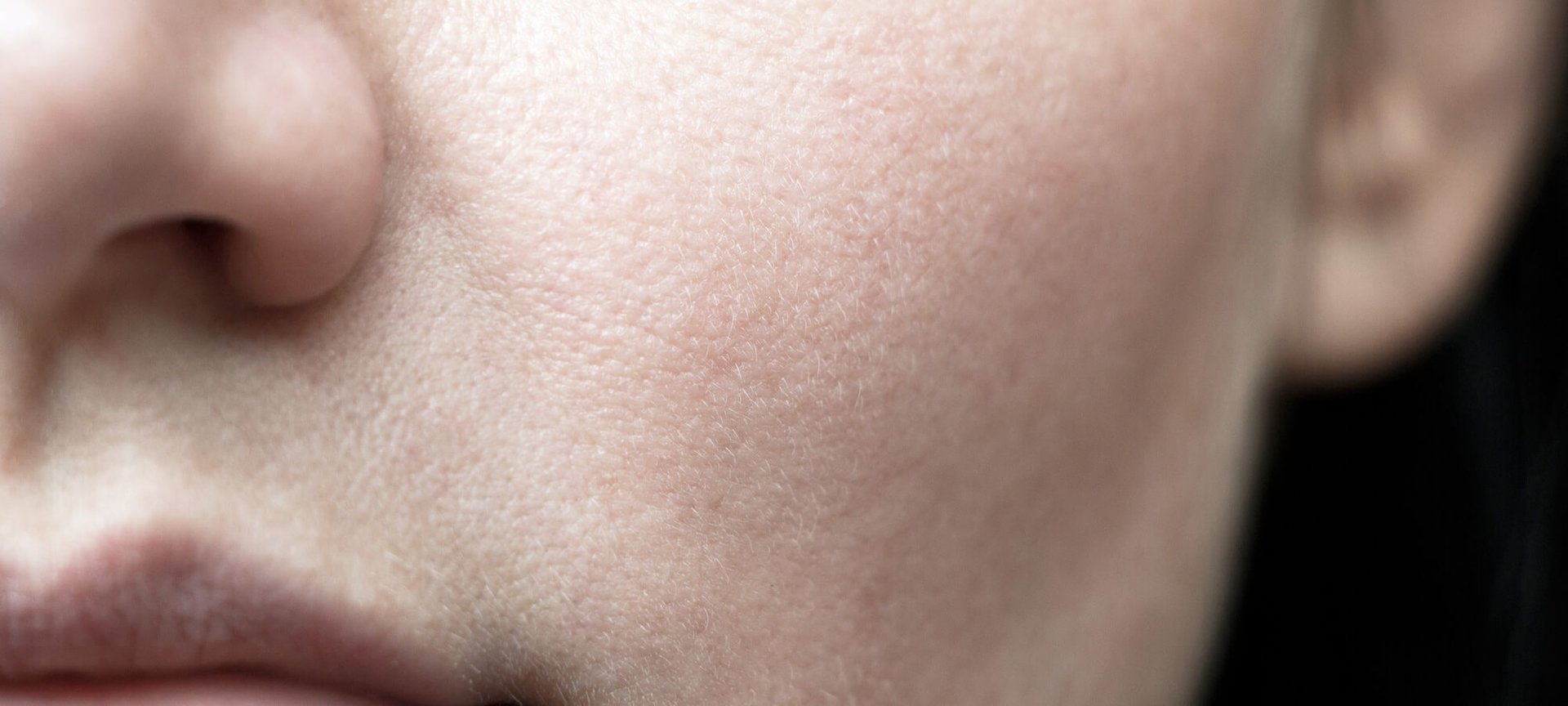 Cara menghilangkan kerutan di bawah mata dengan skincare