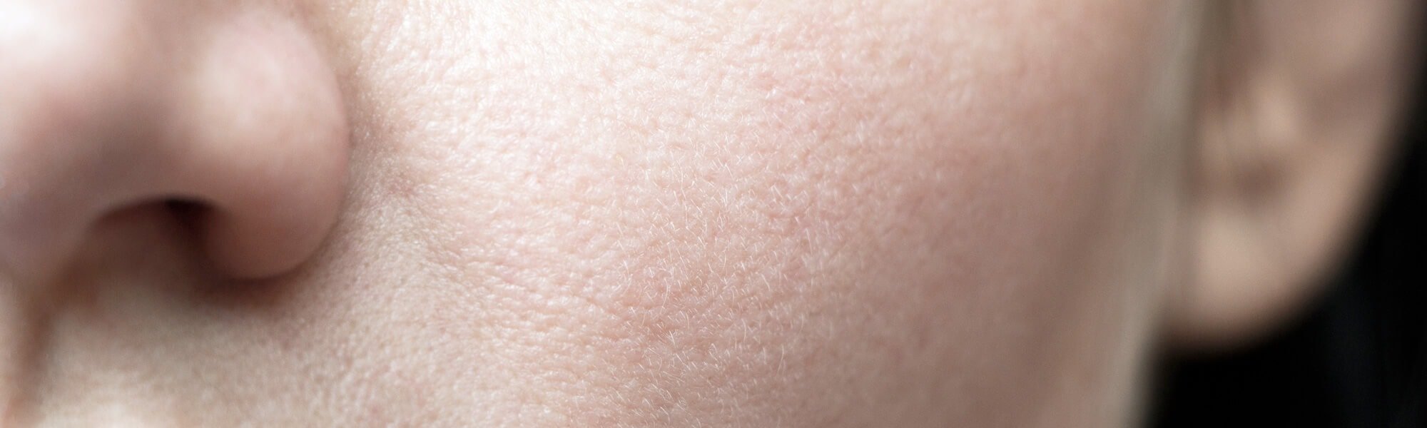 Cara menghilangkan kerutan di bawah mata dengan skincare