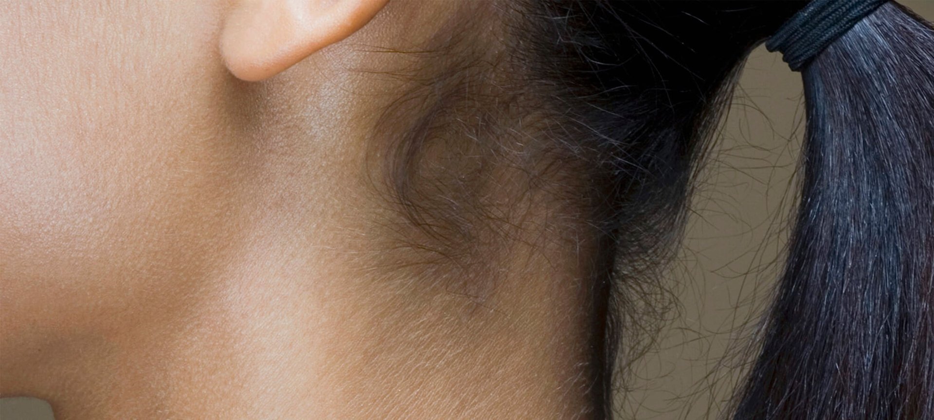 Pigmentasi Yang Pengaruhi Warna Kulit