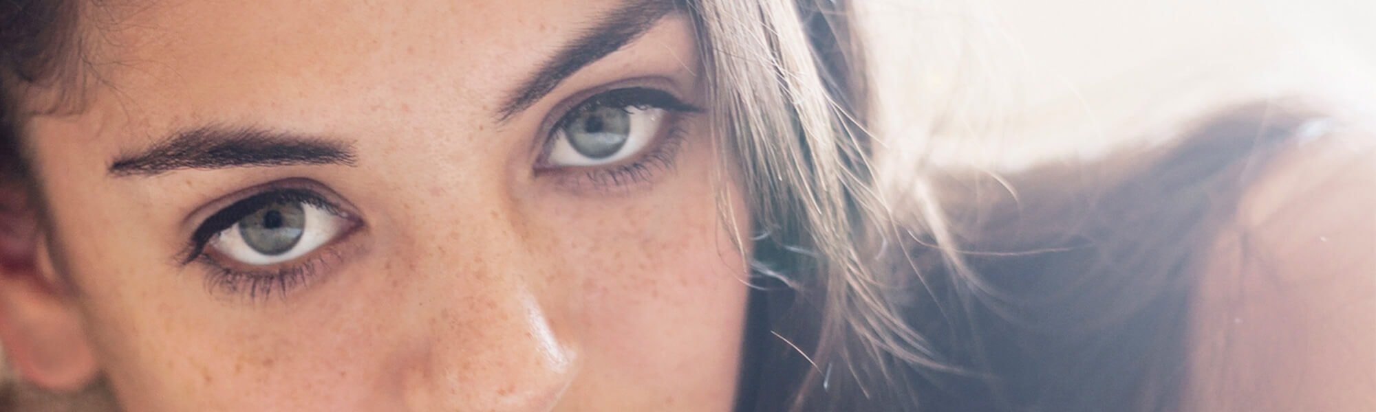 PENYEBAB FLEK HITAM YANG BISA DIATASI DENGAN GLYCOLIC ACID