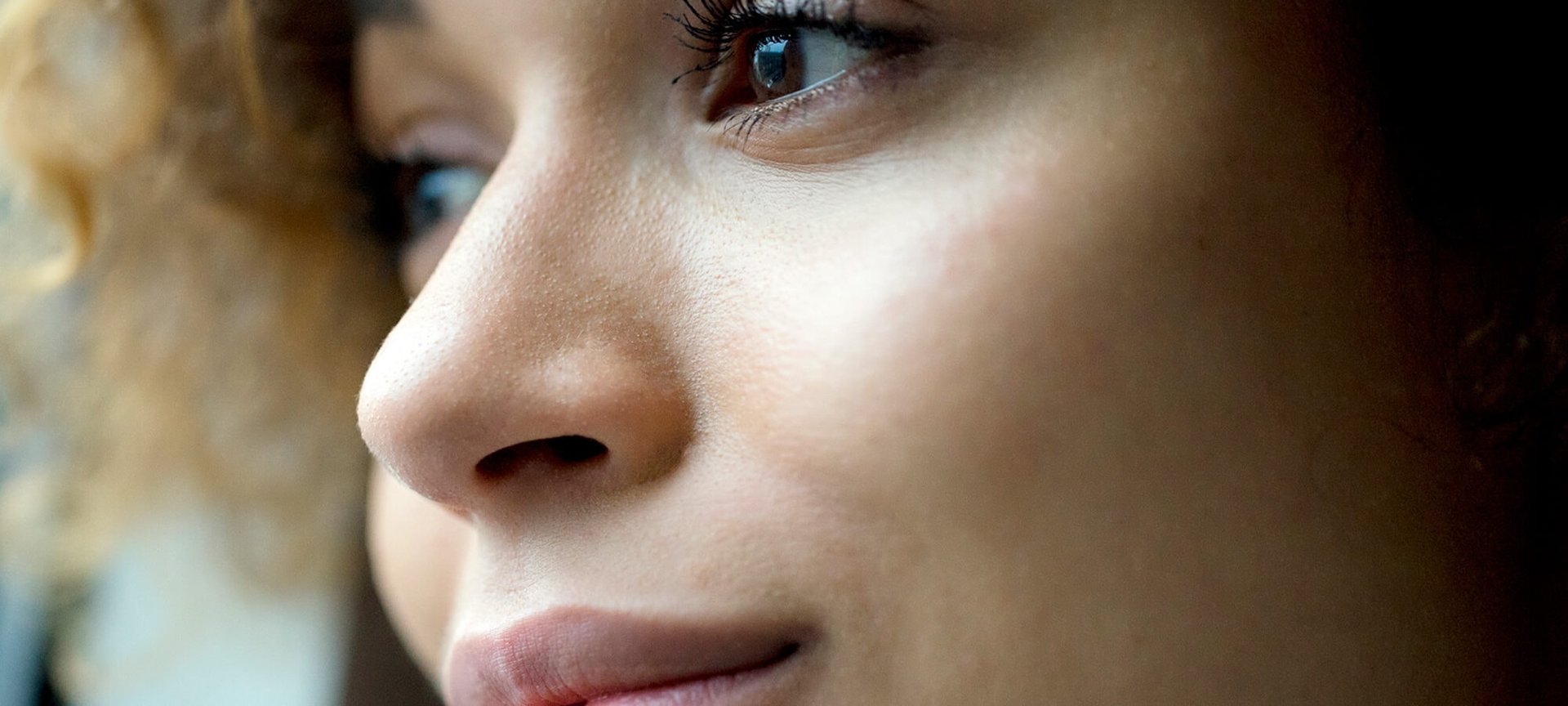 Jangan Khawatir Ini 5 Cara Menghilangkan Bekas Jerawat Hitam