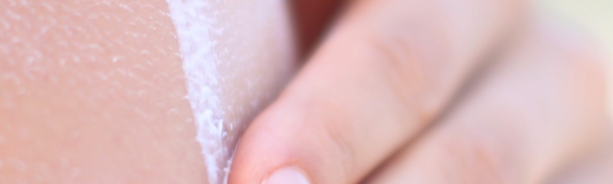 10 Penyebab Stretch Mark Yang Perlu Diketahui