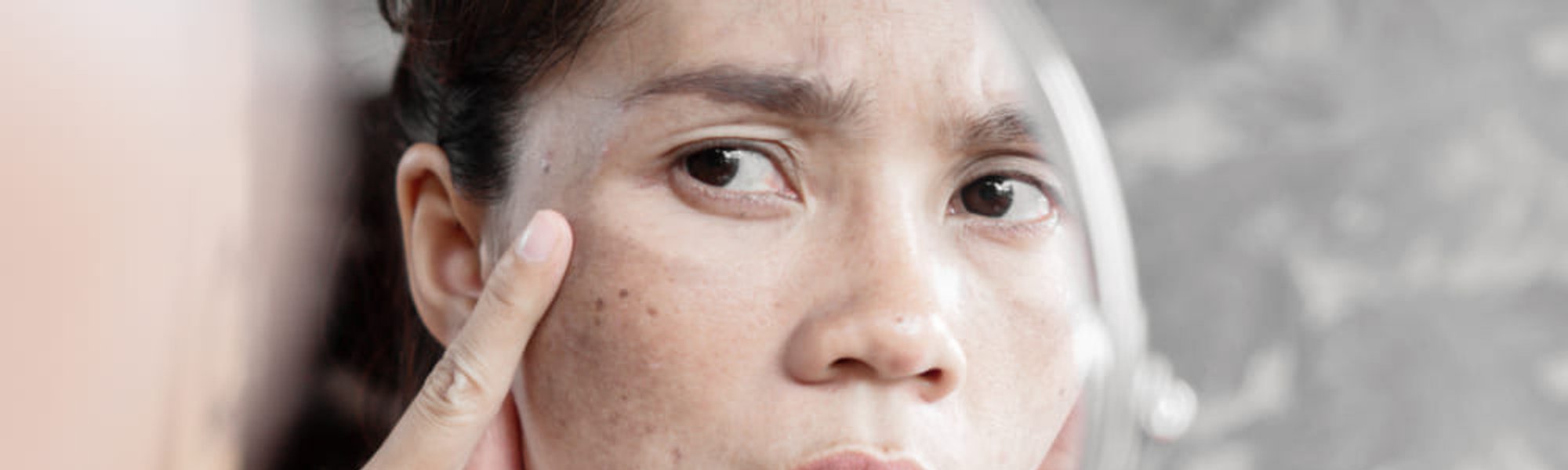 22 Dark Spot Adalah