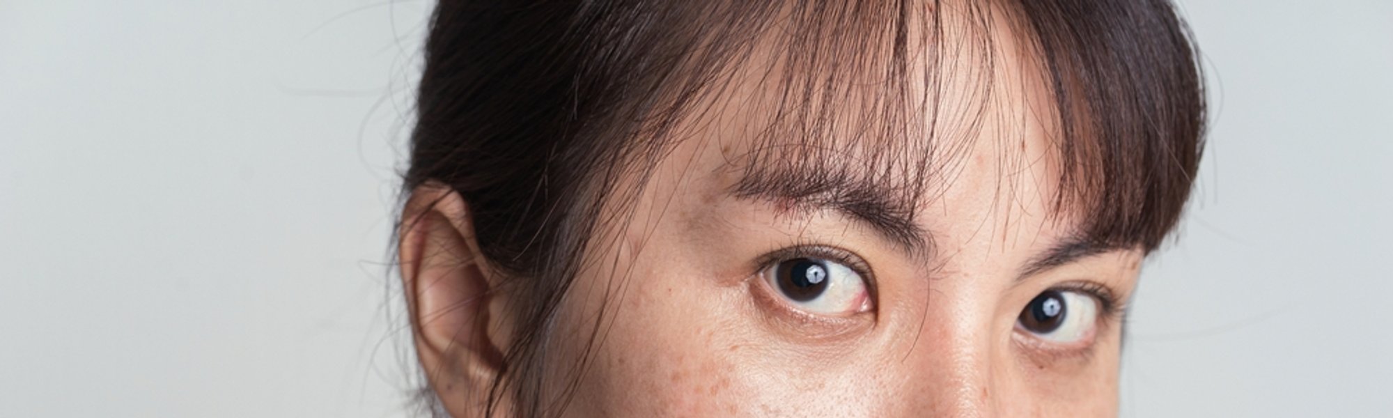27 Freckles Adalah