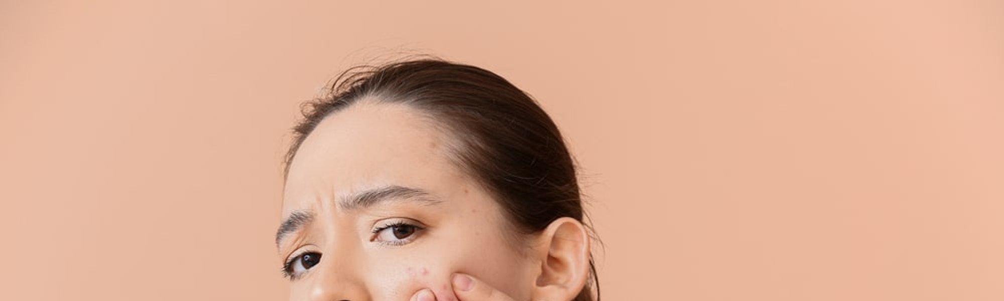 Apa Itu Niacinamide