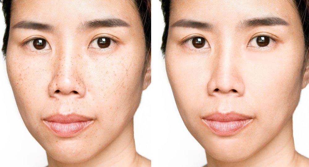 Buah Untuk Mencerahkan Kulit