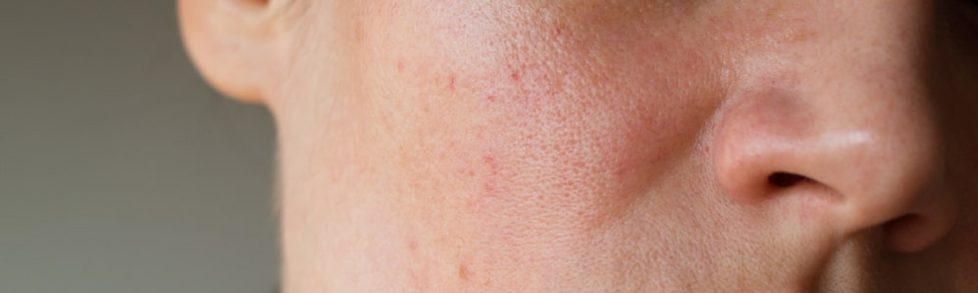 Serum Penghilang Flek Hitam