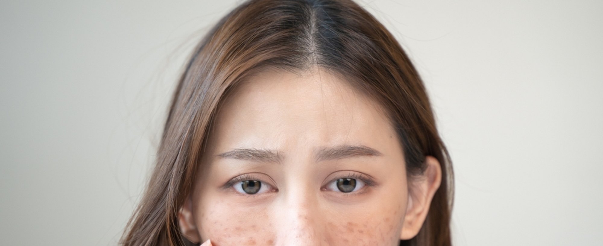 54 5 Penyebab Flek Hitam Di Hidung Dan Cara Menghilangkannya 1