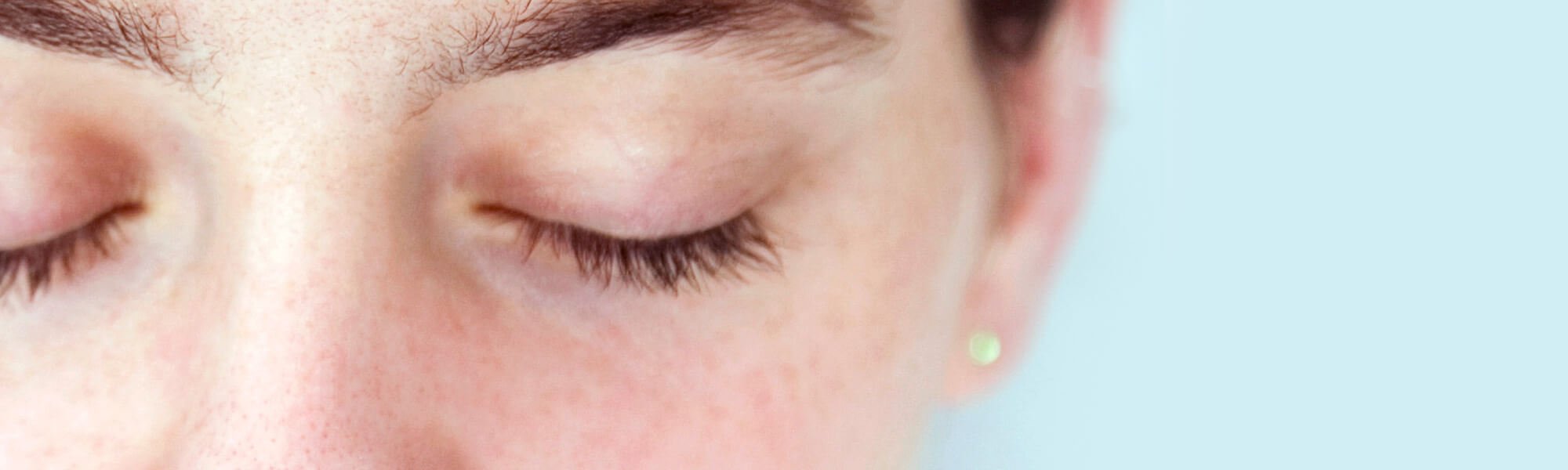 Komedo Hitam Di Hidung Ini Cara Ampuh Menghilangkannya