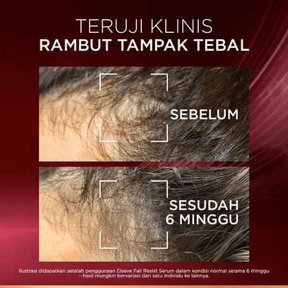 Aplus 4 Aminexil Anti Hair Fall Serum