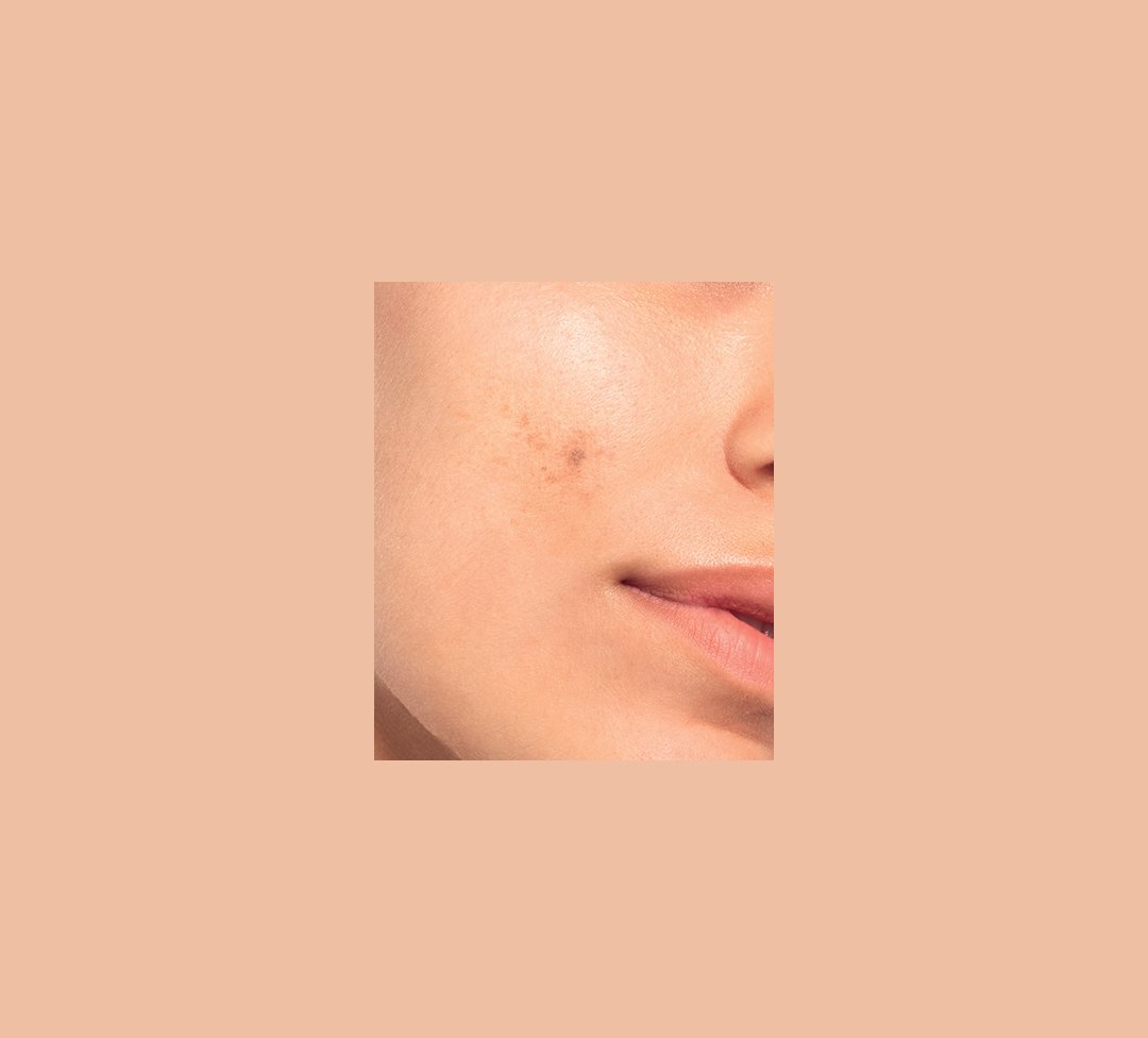 01 Before After Asell