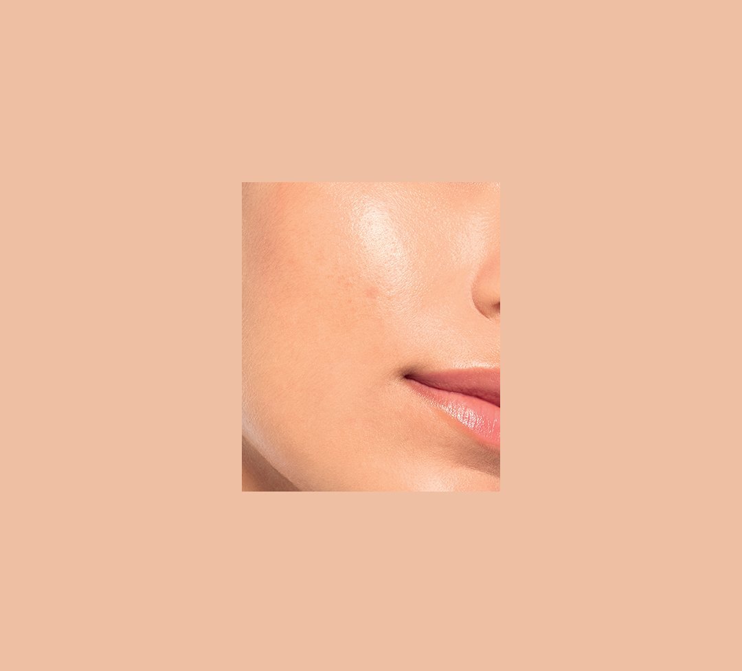 02 Before After Asell