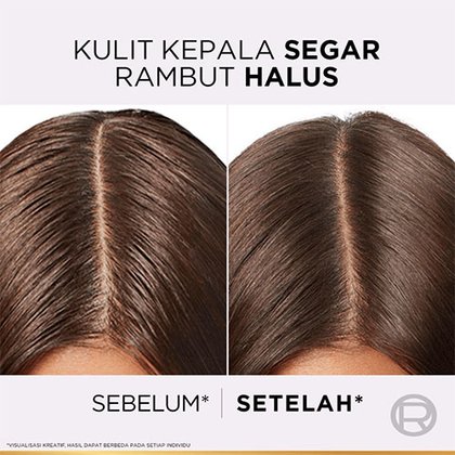 Aplus 3 Elseve Hyaluron Pure Shampoo