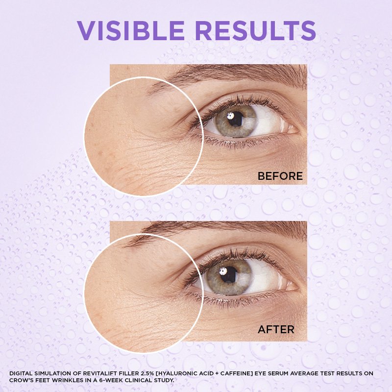 L'Oreal Revitalift Triple Roller 2.5 Hyaluron dari L'Oréal Paris